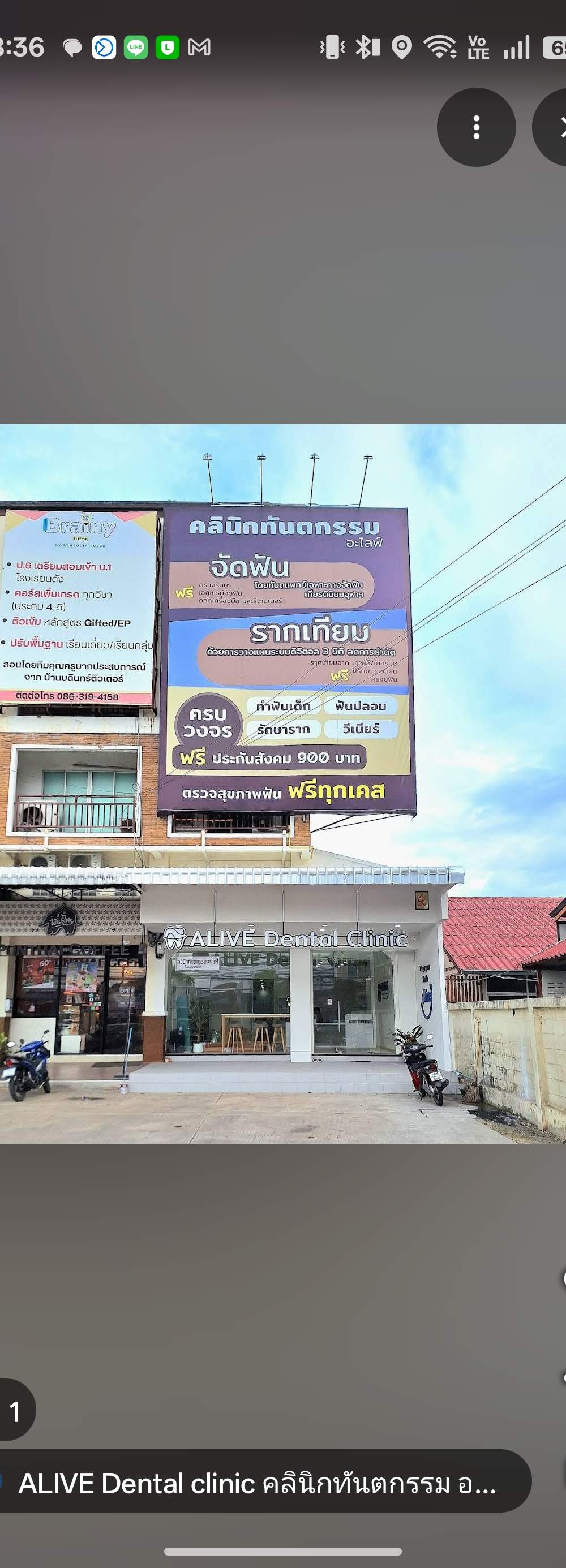 คลินิกทันตกรรมอะไลฟ์